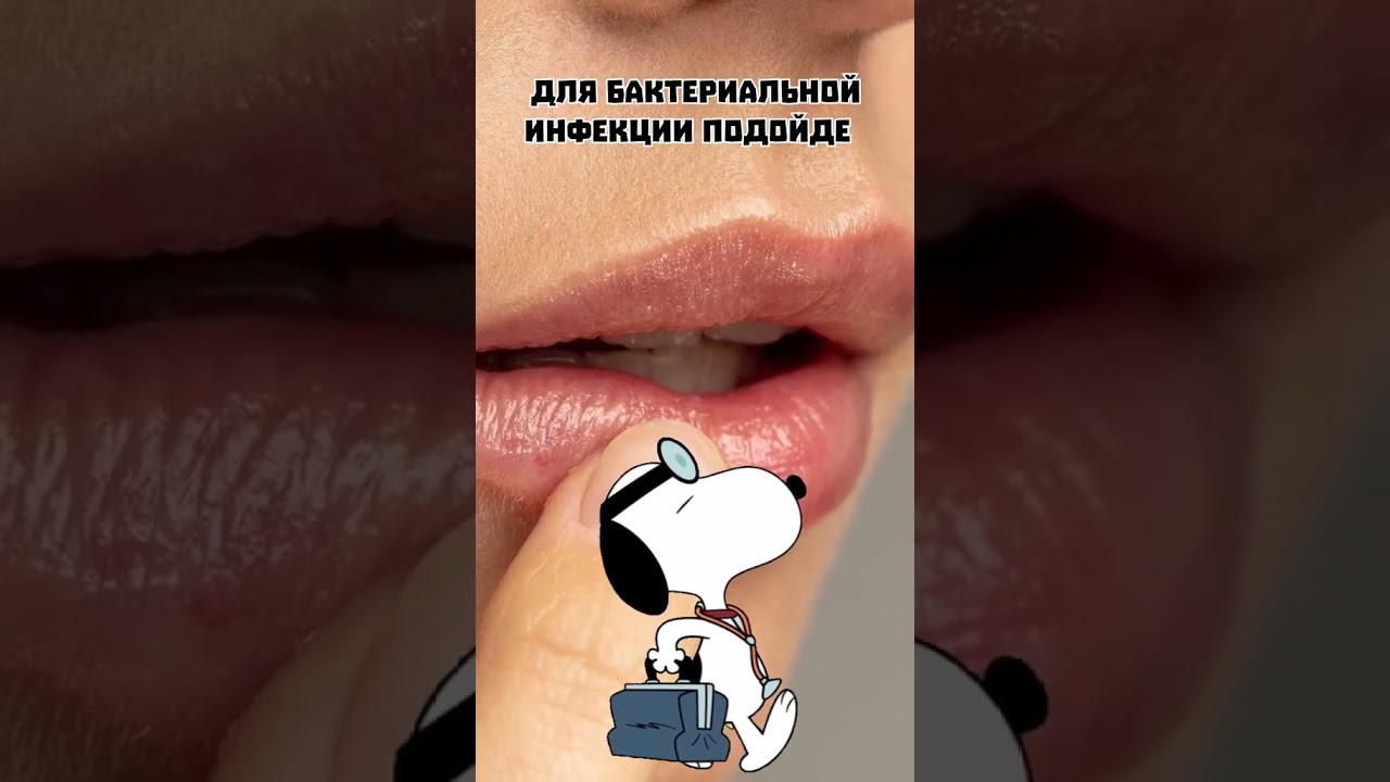 Трещинки в уголках рта причины заед и эффективное лечение #здоровье #долголетие