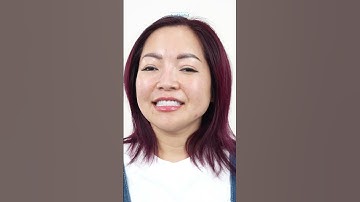 Nụ cười tự tin rạng rỡ sau khi làm răng sứ tại San Dentist #shorts