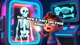 Details ELI5 - How X-Rays See Your Bones News