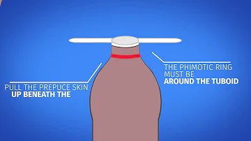 How do you use hydrocortisone cream on foreskin?