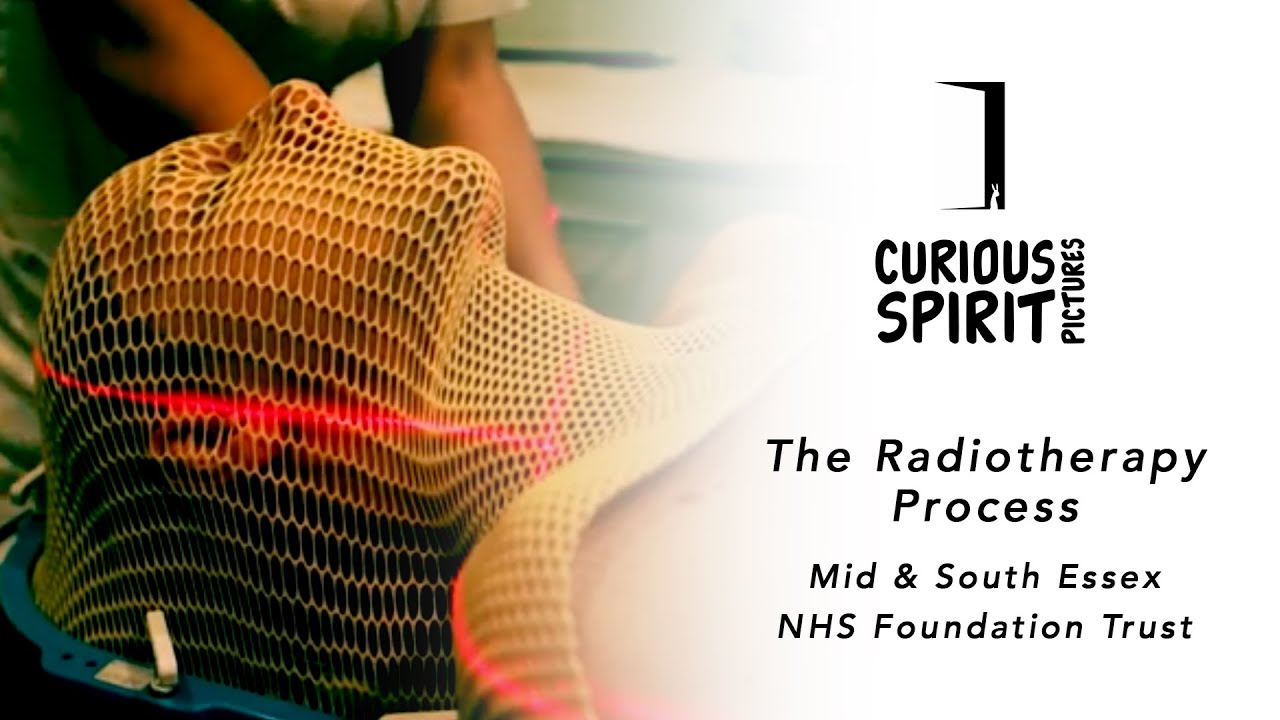 The Radiotherapy Process at Mid & South Essex NHS Foundation Trust
