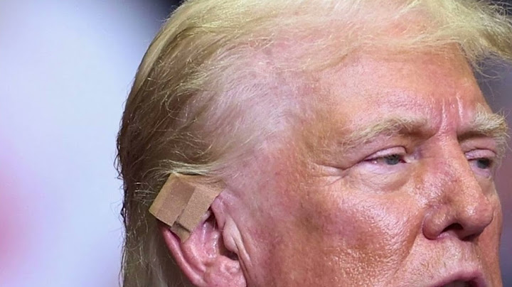 Trump injured but safe after rally shooting; attendee, shooter dead | Special Report