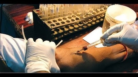 Estimation of Blood Glucose by Glucose Oxidase Method - Amrita University