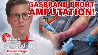 Kopfplatzwunde mit GEHEIMNIS: Gasbrand grassiert im Bein! | Klinik am Südring | SAT.1