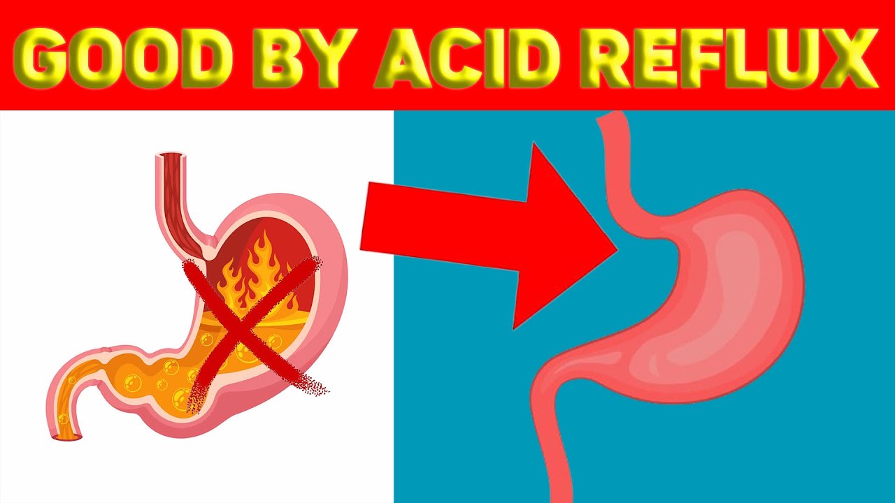 How To Treat Acid Reflux At Home Naturally Your Health YouTube how-to-treat-acid-reflux-at-home-naturally-your-health-youtube