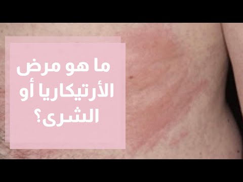 فيديو: ما هي الأمراض التي تسببها alcaligenes faecalis؟