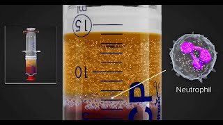 Rome Health Medical Minute Prp Injection