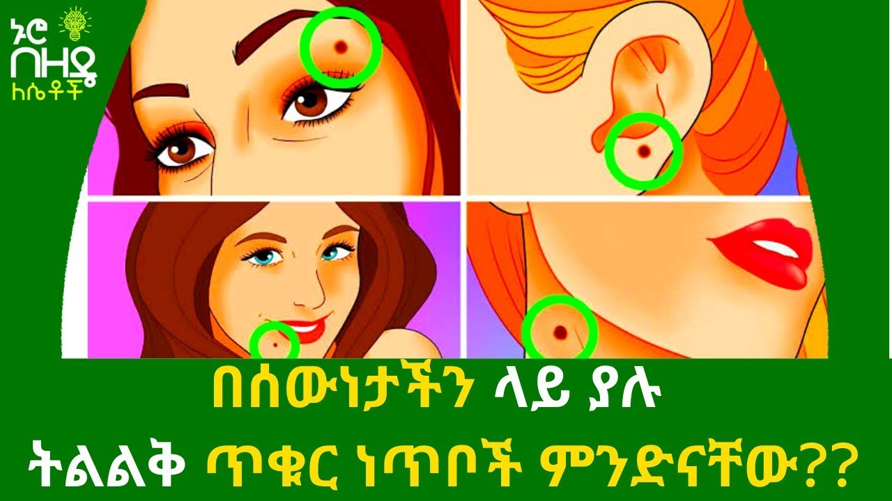 Ethiopia:- በሰውነታችን ላይ ያሉ ትልልቅ ጥቁር ነጥቦች ምንድናቸው ስለ እኛነታችን የሚናገረው ነገር አለ | Nuro Bezede Girls