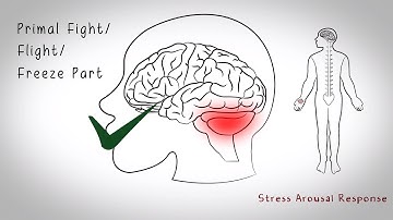 Brain Acute Pain Handling Whiteboard Animation