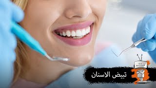 طرق تبيض الاسنان