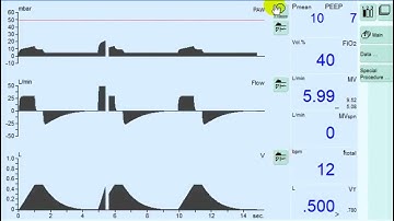 The Impact of Flow Rate on Volume Controlled Mode of Ventilation (CMV)