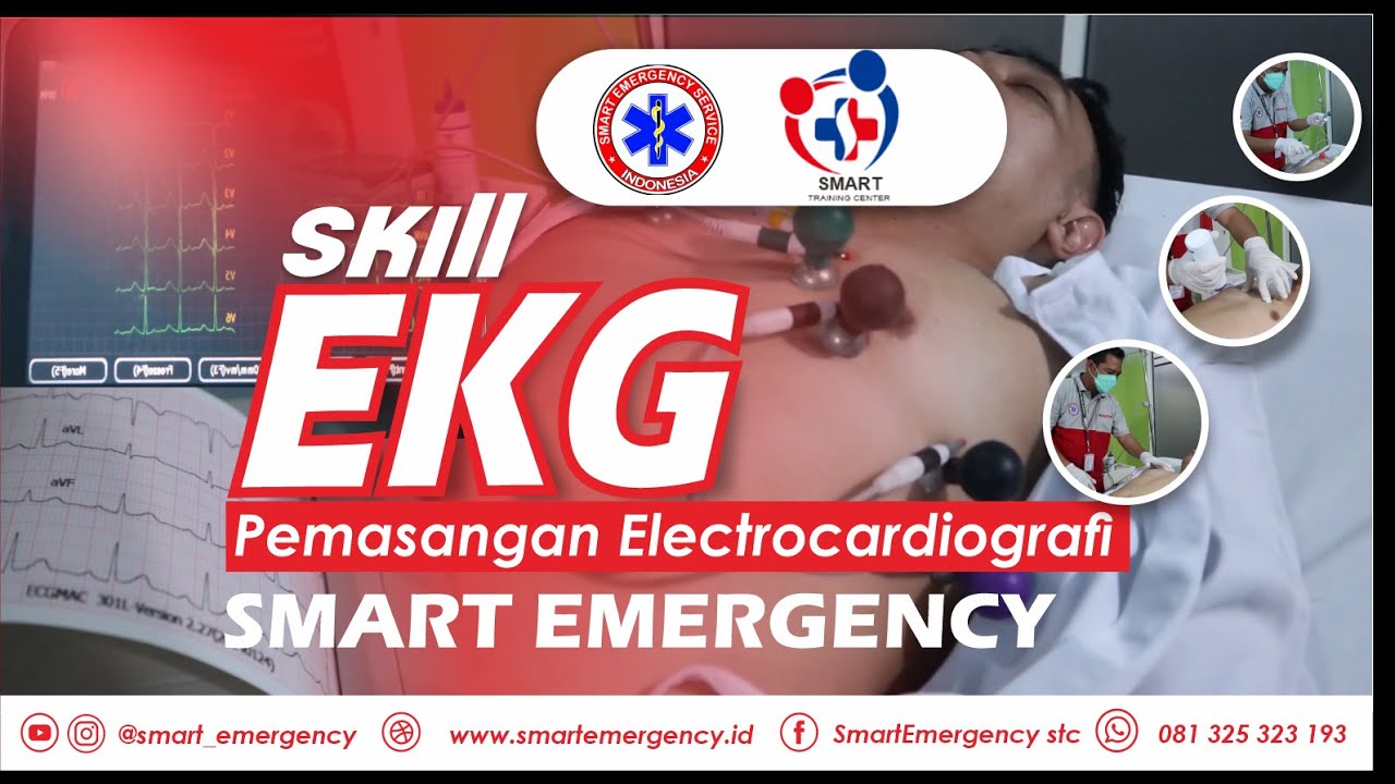 Skill EKG PEMASANGAN ELECTROCARDIOGRAFI | PELATIHAN BTCLS | SMART EMERGENCY