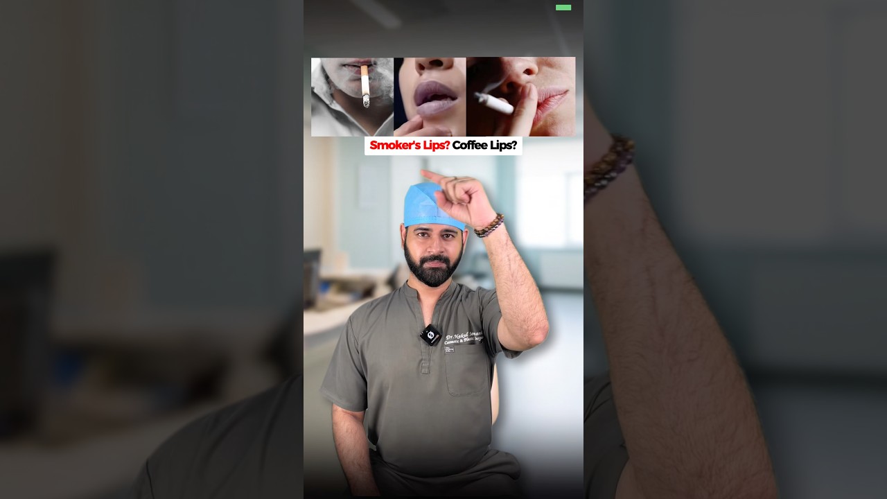 A simple solution to Smoker/Coffee Lips.-Dr. Nakul Somani (Cosmetic & Plastic Surgeon)