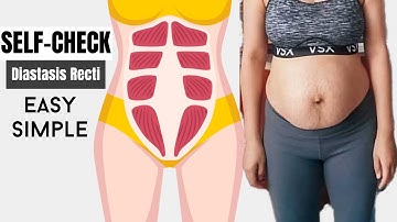 Super Simple Self-Check Diastasis Recti (both gap and depth)