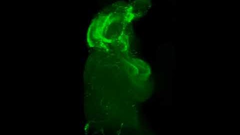 3D image of neurons essential for fear conditioning