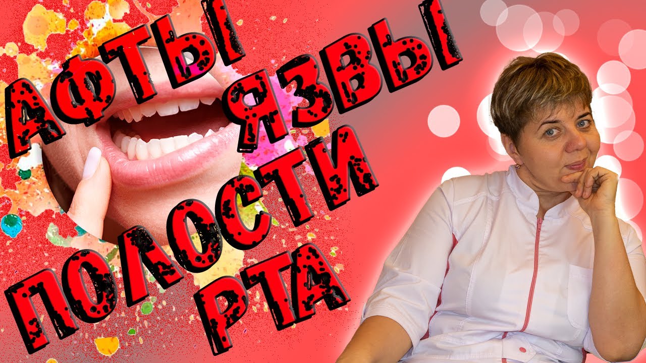 👅 ЯЗВЫ во 👄 рту ️ Ранки во рту.💊 Доктор Кострик объясняет - YouTube