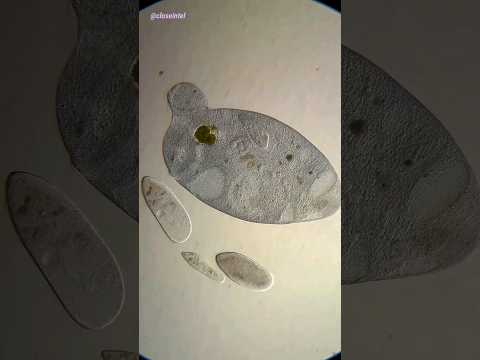 Cell Living Inside Of Another Cell Under Microscope Stentor And Paramecium