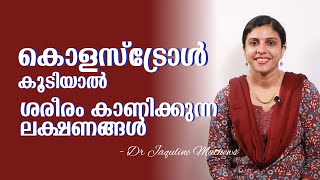 High cholesterol symptoms | കൊളസ്ട്രോൾ കൂടിയാൽ | ലക്ഷണങ്ങൾ | Dr Jaquline Mathews BAMS