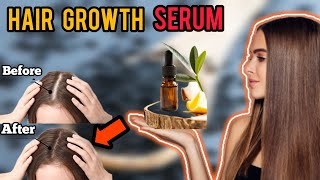 DIY Hair Growth Serum | Extreme Hair Growth Serum At Home | Best Treatment For Baldness