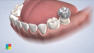 Why Save Baby Teeth in Amarillo TX | AOMS Pediatric & Children's Dentistry