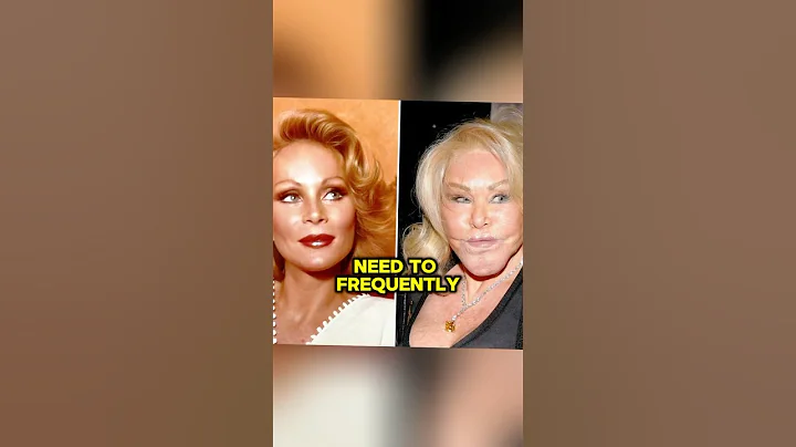 No wonder Jocelyne Wildenstein wore sunglasses during her final public appearance.#shorts #facts