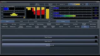 Omnia.9 (PTN) Preset Testing #2