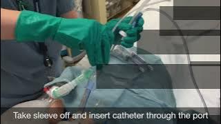 BAL Catheter with Instruction