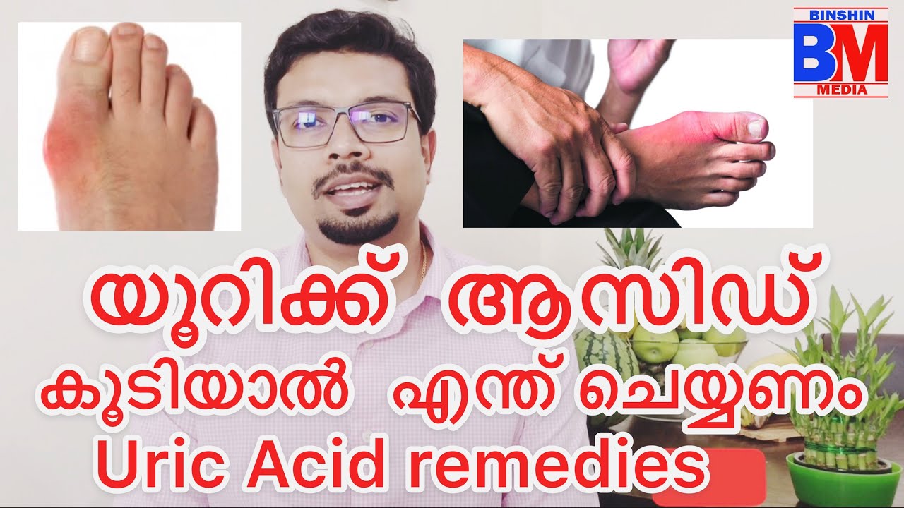 യൂറിക് ആസിഡ് കൂടിയാൽ Uric acid remedies in keto diet