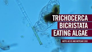 Trichocerca Bicristata eating Algae | by Motic Europe