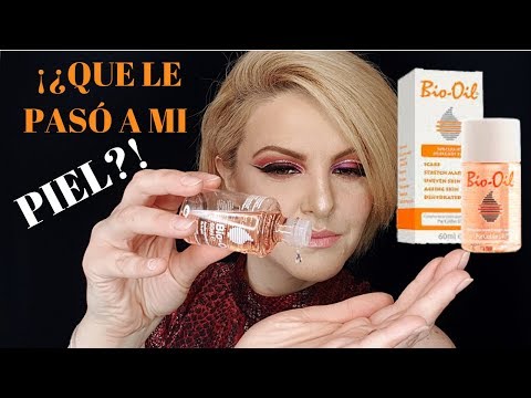 Vídeo: Bio Oil Para El Acné: ¿ayuda O Contribuye A Los Problemas De La Piel?