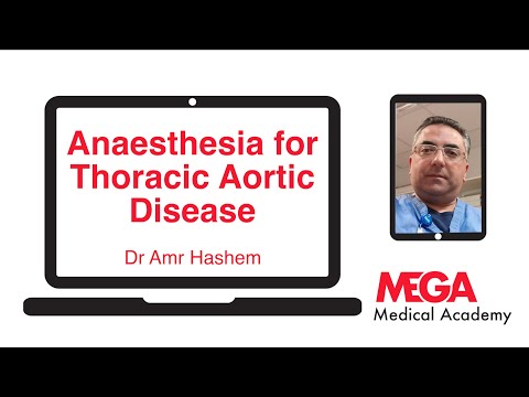 Anaesthesia for Thoracic