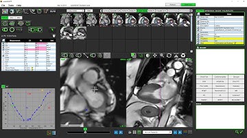 suiteHEART Version 5 0 1 Function Analysis Demonstration Video NS 03 000 0007 Rev1