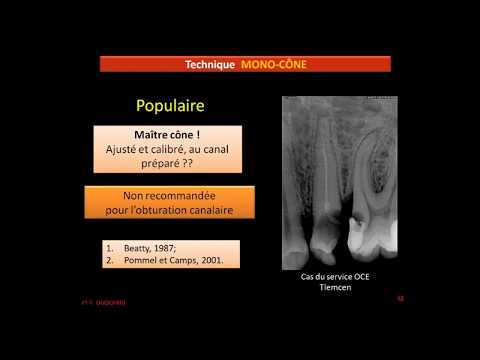 Vidéo: Obturation Des Canaux Radiculaires, Des Voies Urinaires - Types, Causes, Traitement