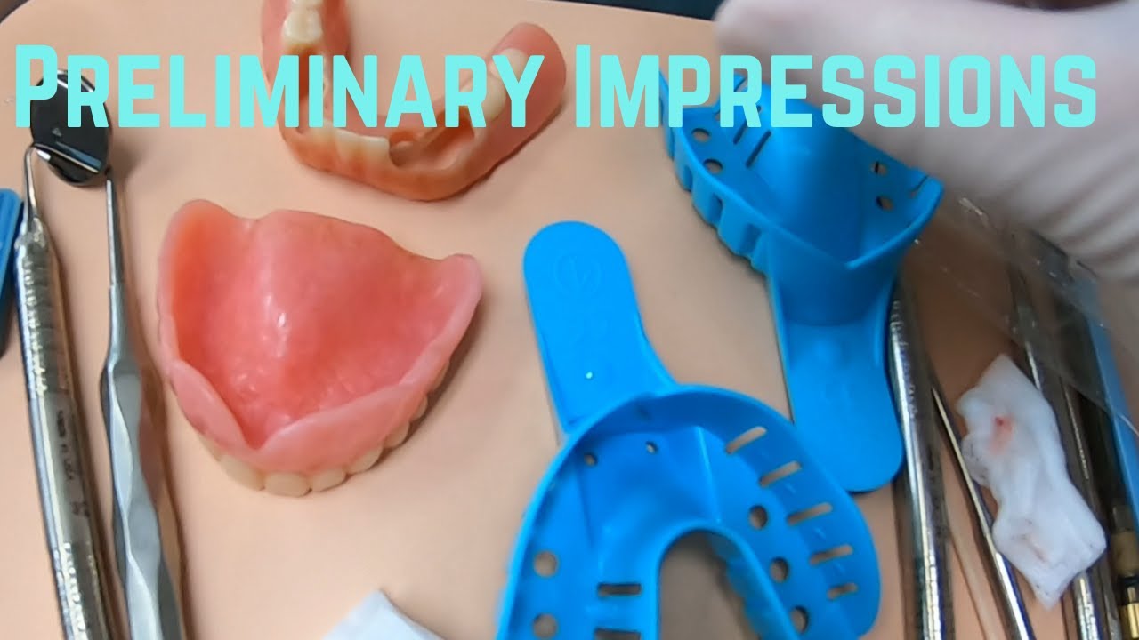 What Are Preliminary Impressions Used To Make Preliminary impressions for an Upper full denture and a lower Cu-sil