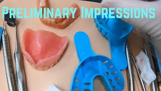 Preliminary impressions for an Upper full denture and a lower Cu-sil partial denture. by Very Nice Smile Dental 4,989 views 10 months ago 1 minute, 29 seconds