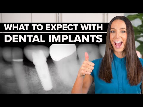 What To Expect With Dental Implants
