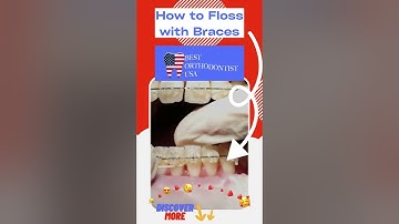 How to Floss with Braces #Shorts #floss #braces