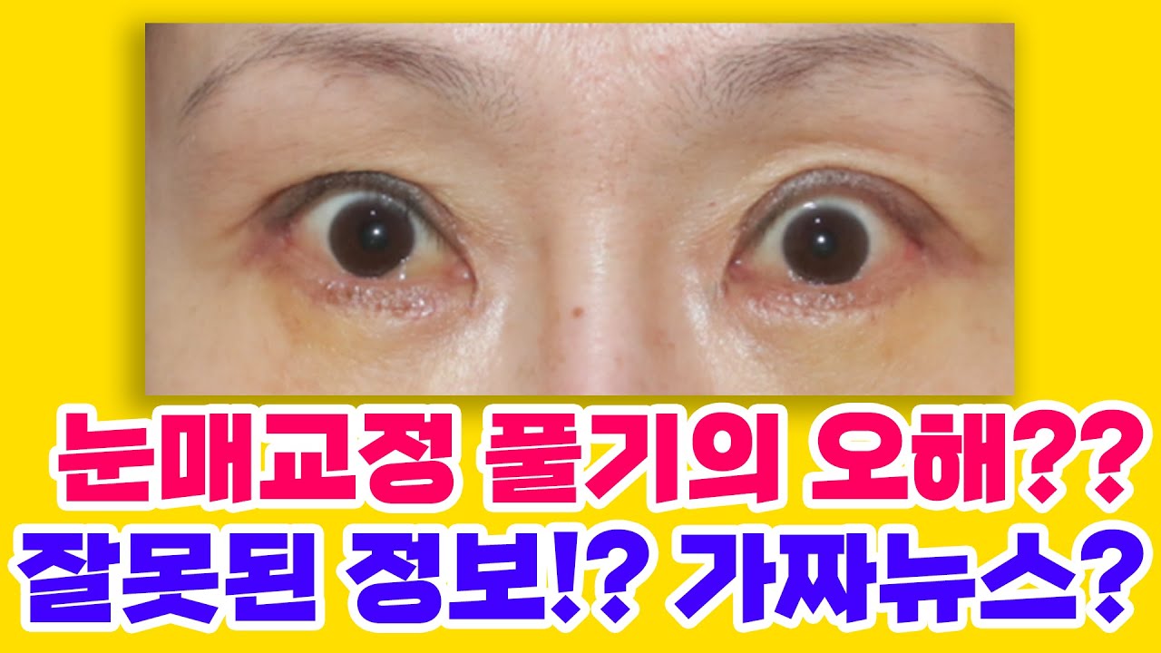 [Ганнам Соён гоо сайхны мэс заслын эмнэлэг] Гоо сайхны мэс заслын зөвлөгөө өгөх газар 💌
Нүдний хэлбэр заслыг буцаахтай холбоотой ташаа ойлголт уу?? Буруу мэдээлэл үү!? Хуурамч мэдээ юу?