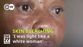 Skin bleaching: The risks behind the beauty craze