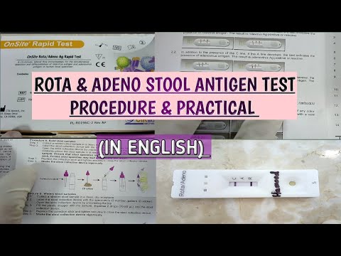 Rota & Adeno ontlasting snelle antigeentest.Waarom deze test nodig is.Procedure en praktisch uitgelegd op een eenvoudige manier