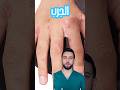مرض مزعج جدا منتشر بشكل كبير ولازم تعرف هالمعلومات عنو الجرب 