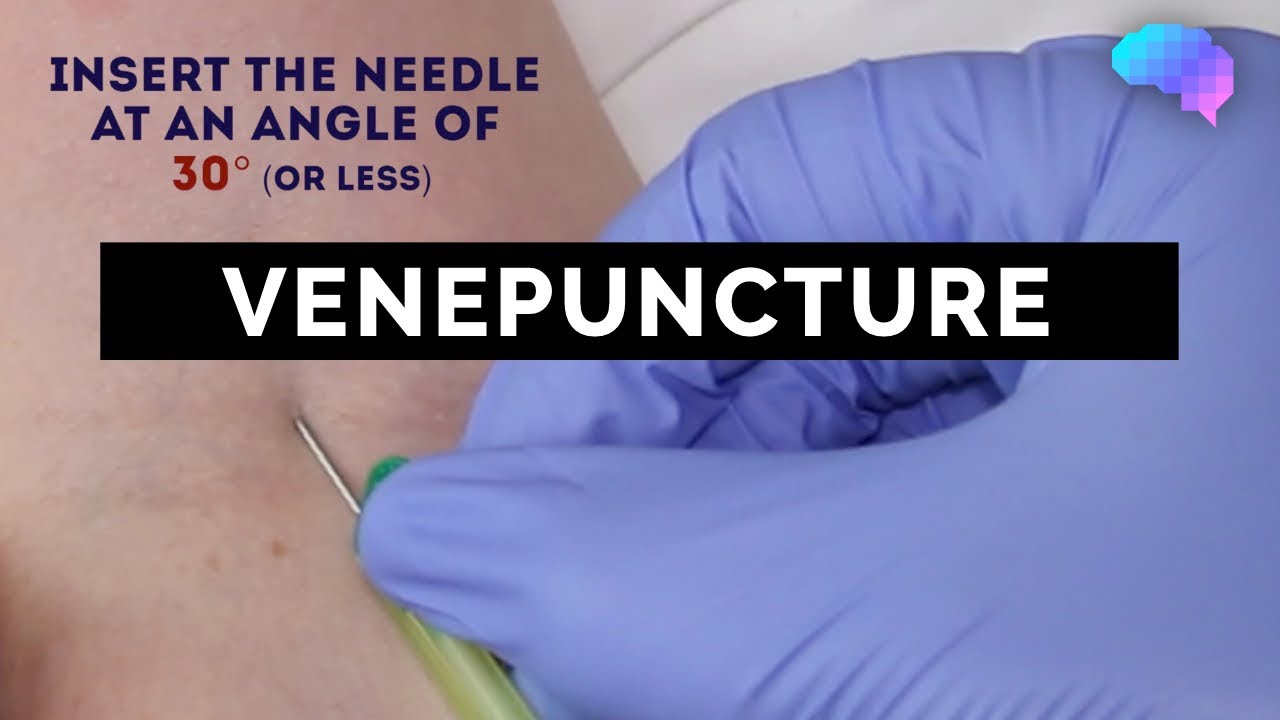 venous blood is clotted in a test tube Venepuncture - How to take a blood sample - OSCE Guide