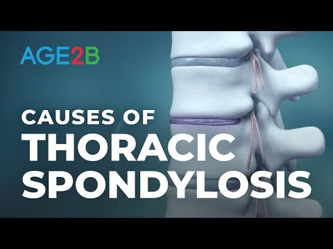 थोरैसिक स्पोंडिलोसिस का क्या कारण बनता है? | मध्य-पीठ या थोरैसिक दर्द | थोरैसिक रीढ़ की हड्डी में दर्द