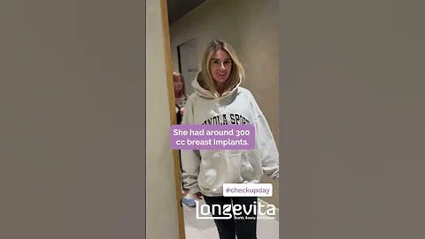 Boob Job in Turkey | Longevita