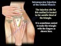 Deltoid Intramuscular injection - Everything You Need To Know - Dr. Nabil Ebraheim