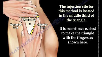 Deltoid Intramuscular injection - Everything You Need To Know - Dr. Nabil Ebraheim