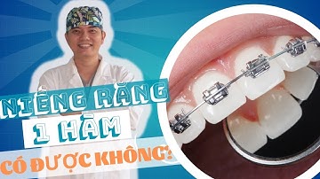 Niềng Răng 1 Hàm Có Được Không?