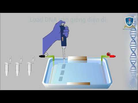 SHPTTH - Điện di trên gel agarose