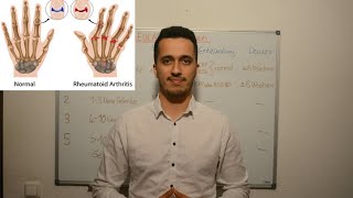 ACR/EULAR Klassifikation für Rheumatoide Arthritis - Rheumatologie - Innere Medizin
