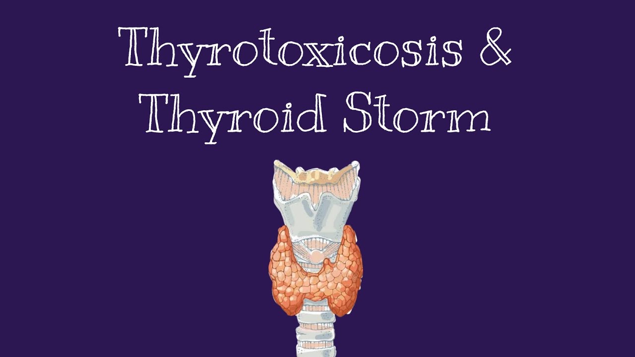 Thyrotoxicosis & Thyroid StormDavidson LectureCauses, Clinical